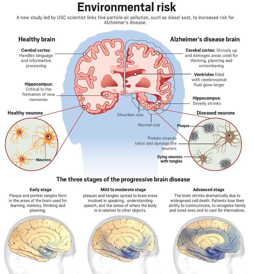 Functional Neurology Vestibular Rehab